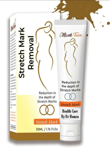 Stretch Mark Removal